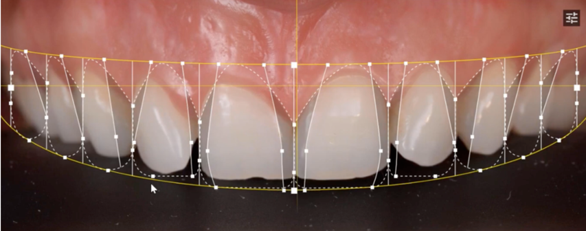 Cabinet dentaire Claude Monet Croissy rehabilitation esthetique sourire
