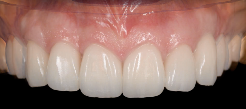 DSD Cabinet Claude Monet Croissy