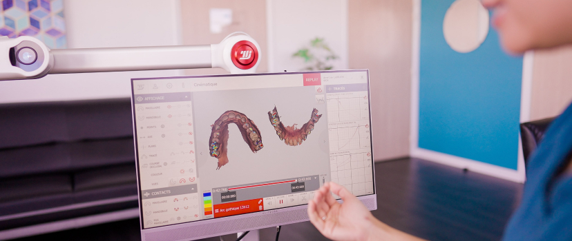 Dr Nguyen cabinet dentaire Claude Monet empreinte optique numerique