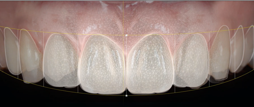 digital smile Cabinet Claude Monet Croissy