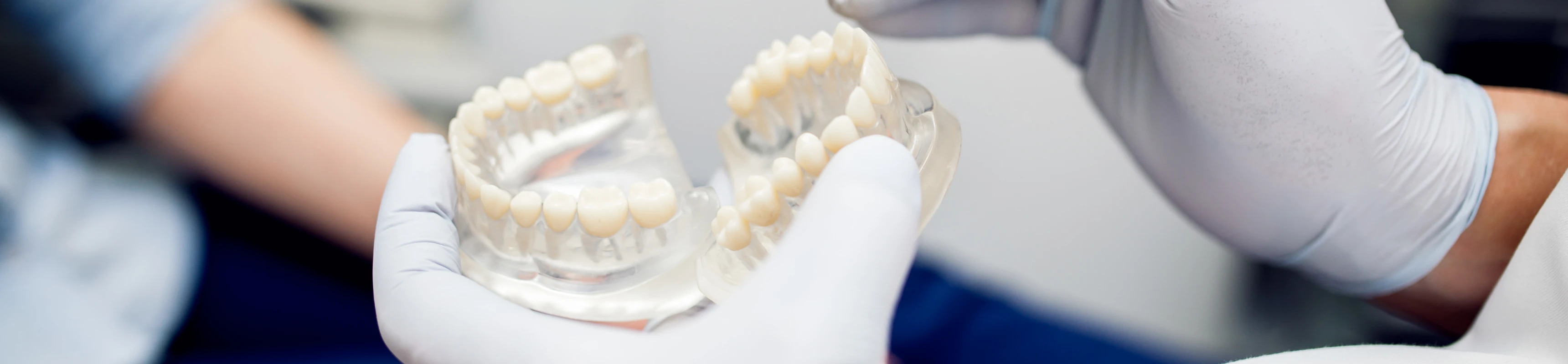 Prothèses dentaires amovibles au cabinet Dentaire Claude Monet à Croissy-sur-Seine