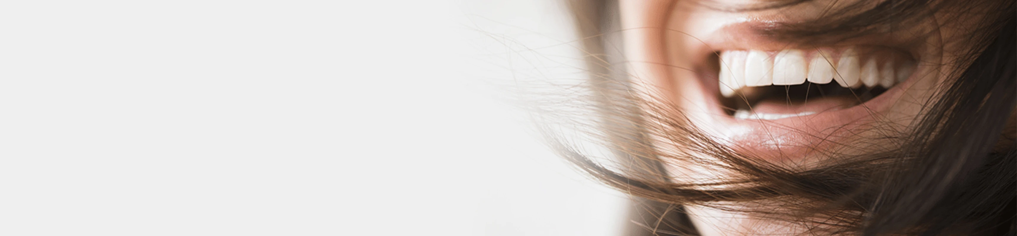 Esthétique du sourire