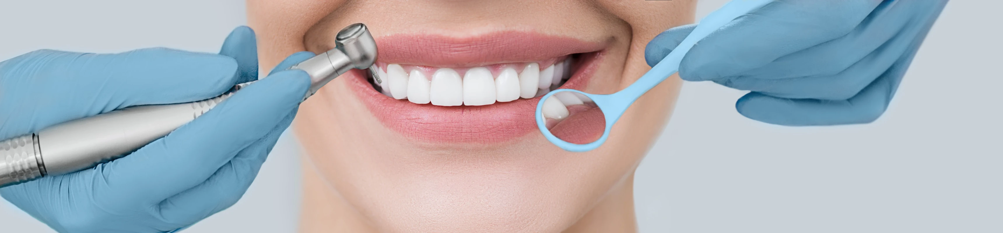 Parodontologie á Groissy Dentiste