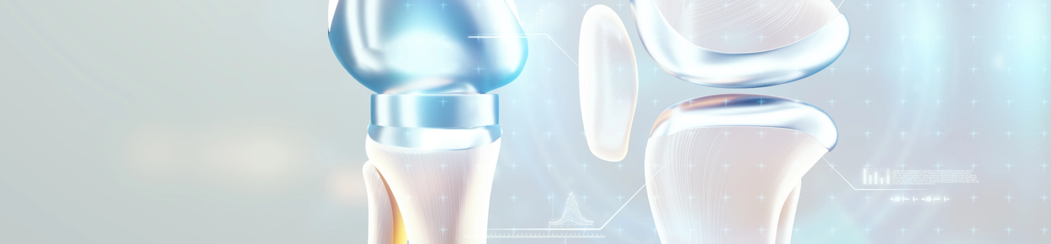 Prothèses articulaires et les dents : cabinet Dentaire Claude Monet à Croissy-sur-Seine